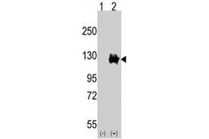 Western blot analysis of TRPM8 (arrow) using rabbit TRPM8 polyclonal antibody . (TRPM8 抗体  (AA 1075-1104))