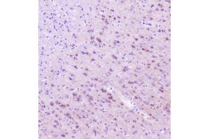 IHC analysis of RASAL1 using anti-RASAL1 antibody (ABIN6719367).