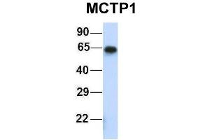 Host:  Rabbit  Target Name:  MCTP1  Sample Type:  Human Fetal Muscle  Antibody Dilution:  1. (MCTP1 抗体  (Middle Region))
