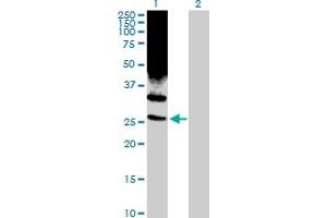 Western Blot analysis of PSMD10 expression in transfected 293T cell line by PSMD10 MaxPab rabbit polyclonal antibody. (PSMD10 抗体  (AA 1-226))