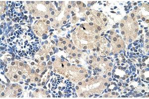 Human kidney (UBR7 抗体  (Middle Region))