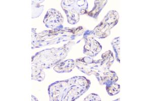 IHC analysis of CD2AP using anti-CD2AP antibody (ABIN6719544).