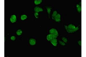 Immunofluorescent analysis of MCF-7 cells using ABIN7150297 at dilution of 1:100 and Alexa Fluor 488-congugated AffiniPure Goat Anti-Rabbit IgG(H+L) (SWI5 抗体  (AA 54-112))