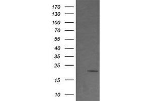 Image no. 2 for anti-NADH Dehydrogenase (Ubiquinone) 1 beta Subcomplex, 9, 22kDa (NDUFB9) (AA 3-179) antibody (ABIN1491359) (NDUFB9 抗体  (AA 3-179))