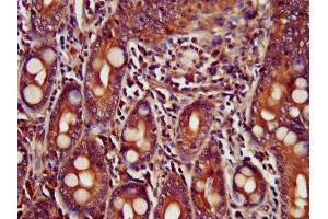 IHC image of ABIN7173439 diluted at 1:400 and staining in paraffin-embedded human small intestine tissue performed on a Leica BondTM system. (TRIM35 抗体  (AA 1-206))