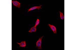 ABIN6262599 and ABIN6273256 staining Hela by IF/ICC. (INSIG1 抗体  (Internal Region))