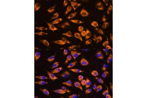 Immunofluorescence analysis of L929 cells using CEP55 antibody (ABIN6127692, ABIN6138423, ABIN6138424 and ABIN6224249) at dilution of 1:100. (CEP55 抗体  (AA 1-260))