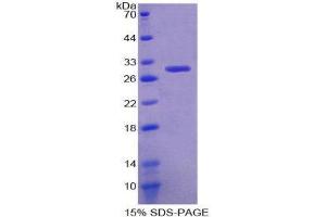 SDS-PAGE (SDS) image for Glutathione S-Transferase theta 1 (GSTT1) (AA 7-240) protein (His tag) (ABIN2125024) (GSTT1 Protein (AA 7-240) (His tag))