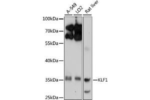 Western blot analysis of extracts of various cell lines, using KLF1 antibody (ABIN6134663, ABIN6142905, ABIN6142906 and ABIN6214882) at 1:1000 dilution. (KLF1 抗体  (AA 1-100))