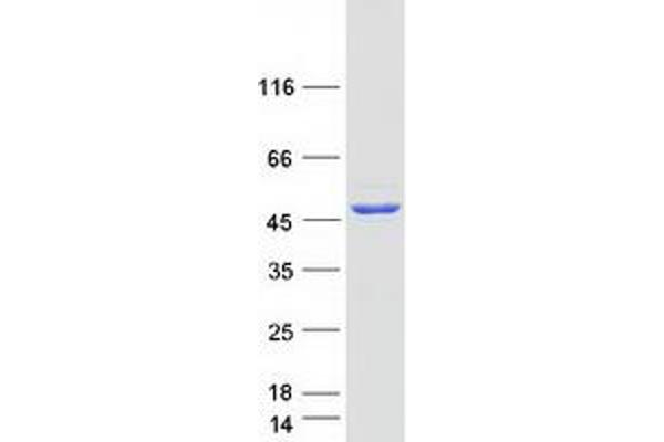 SCCPDH Protein (Myc-DYKDDDDK Tag)