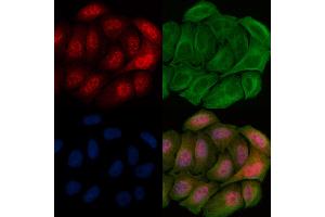 ABIN6256500 and ABIN6267669 staining Hela cells(20 min of 30uM Forskolin treatment) by IF/ICC. (CAMK4 抗体  (pThr200))