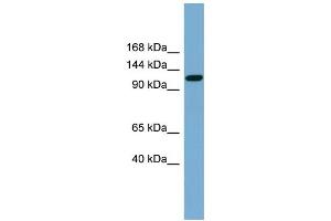 WB Suggested Anti-SLC12A5 Antibody Titration:  0. (KCC2 抗体  (Middle Region))