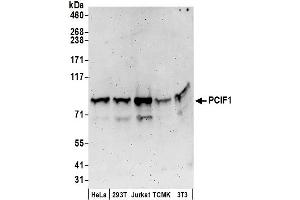 anti-PDX1 C-terminal Inhibiting Factor 1 (PCIF1) (AA 654-704) antibody
