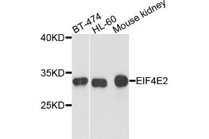 Western blot analysis of extracts of various cell lines, using EIF4E2 antibody. (EIF4E2 抗体)