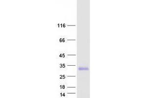 Western Blotting (WB) image for Transmembrane Protein 98 (TMEM98) (Transcript Variant 2) protein (Myc-DYKDDDDK Tag) (ABIN2733916)