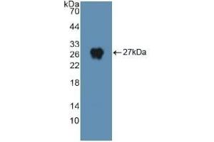 Detection of Recombinant DNM2, Human using Polyclonal Antibody to Dynamin 2 (DNM2) (DNM2 抗体  (AA 533-731))