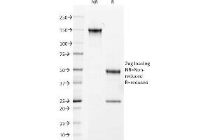 SDS-PAGE Analysis Purified Androgen Receptor Mouse Monoclonal Antibody (AR441). (Androgen Receptor 抗体  (AA 302-318))