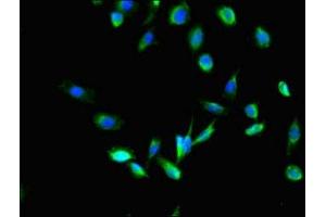 Immunofluorescent analysis of U251 cells using ABIN7158987 at dilution of 1:100 and Alexa Fluor 488-congugated AffiniPure Goat Anti-Rabbit IgG(H+L) (MPDU1 抗体  (AA 1-36))