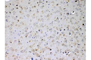 IHC analysis of IL15RA using anti-IL15RA antibody . (IL15RA 抗体  (AA 31-174))