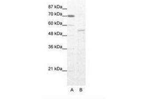 Image no. 1 for anti-Zinc Finger Protein 665 (ZNF665) (AA 146-195) antibody (ABIN202996) (ZNF665 抗体  (AA 146-195))