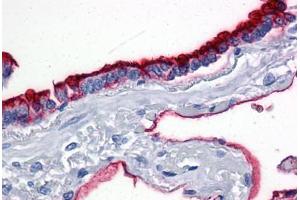 Lung, Human: Formalin-Fixed, Paraffin-Embedded (FFPE) (MUC1 抗体)
