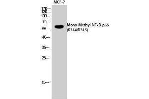 Western Blotting (WB) image for anti-Nuclear Factor-kB p65 (NFkBP65) (acLys314), (acLys315) antibody (ABIN3181858) (NF-kB p65 抗体  (acLys314, acLys315))