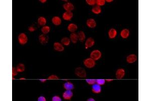 Immunofluorescence analysis of HeLa cells using CYP11B2 Polyclonal Antibody at dilution of 1:100 (40x lens). (CYP11B2 抗体)
