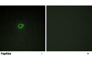 Immunofluorescence analysis of COS-7 cells, using COL4A4 polyclonal antibody . (Col4a4 抗体)