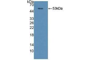 Detection of Recombinant CPR, Human using Polyclonal Antibody to Cytochrome P450 Reductase (CPR) (POR 抗体  (AA 77-518))