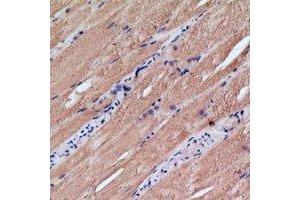 Immunohistochemical analysis of MRPS18C staining in human skeletal muscle formalin fixed paraffin embedded tissue section. (MRPS18C 抗体)