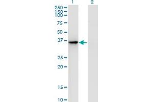 Western Blot analysis of AKR1D1 expression in transfected 293T cell line by AKR1D1 monoclonal antibody (M01), clone 1A6. (AKR1D1 抗体  (AA 227-326))