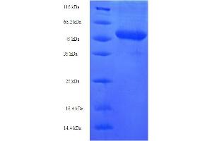 Neuregulin 2 (NRG2) (AA 112-405) protein (His-SUMO Tag)