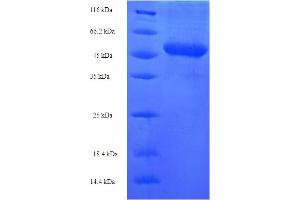 SDS-PAGE (SDS) image for Neuregulin 2 (NRG2) (AA 112-405) protein (His-SUMO Tag) (ABIN5710027) (Neuregulin 2 Protein (NRG2) (AA 112-405) (His-SUMO Tag))