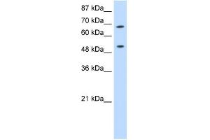 WB Suggested Anti-THOC1 Antibody Titration:  0. (THOC1 抗体  (C-Term))