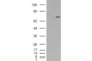 Image no. 2 for anti-Premelanosome Protein (PMEL) (C-Term) antibody (ABIN374704) (Melanoma gp100 抗体  (C-Term))