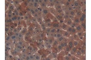 Immunohistochemistry (IHC) image for anti-Lectin, Galactoside-Binding, Soluble, 9 (LGALS9) (AA 225-353) antibody (ABIN7438190)