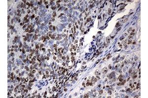 Image no. 2 for anti-Antigen Identified By Monoclonal Antibody Ki-67 (MKI67) (AA 1160-1493) antibody (ABIN1490857) (Ki-67 抗体  (AA 1160-1493))