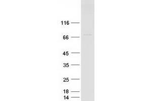 Western Blotting (WB) image for Premature Ovarian Failure, 1B (POF1B) protein (Myc-DYKDDDDK Tag) (ABIN2729279)