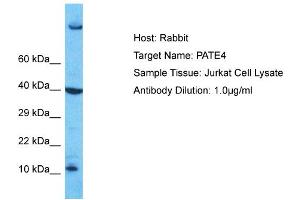 Host: Rabbit Target Name: PATE4 Sample Type: Jurkat Whole Cell lysates Antibody Dilution: 1. (PATE4 抗体  (Middle Region))