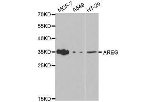 Western blot analysis of extracts of various cell lines, using AREG antibody. (Amphiregulin 抗体  (AA 20-252))