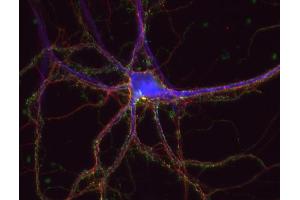 Immunocytochemistry (ICC) image for anti-tau Protein (AA 3-214) antibody (ABIN1742567) (tau 抗体  (AA 3-214))