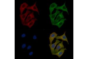 p23 Mouse Monoclonal Antibody staining Hela cells by IF/ICC. (CDK5R1 抗体)