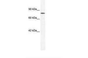 Image no. 1 for anti-Zinc Finger Protein 214 (ZNF214) (AA 37-86) antibody (ABIN202807) (ZNF214 抗体  (AA 37-86))