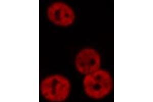 ABIN6276374 staining Hela cells by IF/ICC. (Retinoic Acid Receptor alpha 抗体  (N-Term))