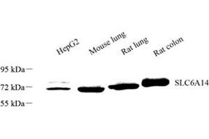 Western blot analysis of SLC6A14 (ABIN7075677) at dilution of 1: 1000 (Slc6a14 抗体)