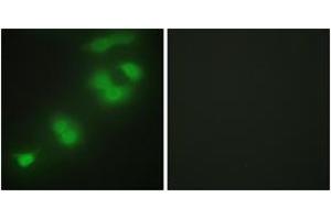 Immunofluorescence analysis of HepG2 cells, using CREBZF Antibody. (CREBZF 抗体  (AA 221-270))