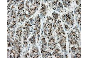 Immunohistochemical staining of paraffin-embedded pancreas tissue using anti-ERCC1 mouse monoclonal antibody. (ERCC1 抗体)