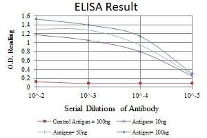 Red: Control Antigen (100 ng), Purple: Antigen (10 ng), Green: Antigen (50 ng), Blue: Antigen (100 ng), (EPH Receptor A10 抗体)