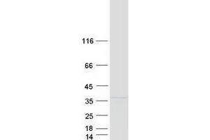 Western Blotting (WB) image for CTD (Carboxy-terminal Domain, RNA Polymerase II, Polypeptide A) Small Phosphatase 1 (CTDSP1) (Transcript Variant 1) protein (Myc-DYKDDDDK Tag) (ABIN2712605)