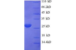 SDS-PAGE (SDS) image for SIVA1, Apoptosis-Inducing Factor (SIVA1) (AA 1-110) protein (His-SUMO Tag) (ABIN5710366)
